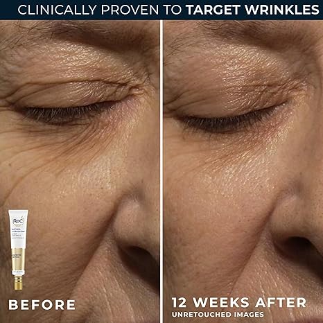 RoC Retinol Correxion Value Set Duo – Deep Wrinkle Anti-Aging Night Cream & Retinol Eye Cream for Dark Circles, Puffiness, and Fine Lines – Dermatologist Tested