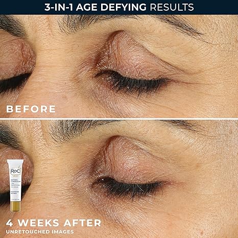 RoC Retinol Correxion Value Set Duo – Deep Wrinkle Anti-Aging Night Cream & Retinol Eye Cream for Dark Circles, Puffiness, and Fine Lines – Dermatologist Tested